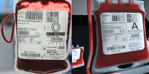 An image showing a real red cell unit compared with the virtual one.